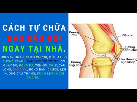 Đau Xương Bánh Chè Đùi - Đau mặt trước gối cách chữa tại nhà cùng Bác sĩ Thể thao Nguyễn Trọng Thuỷ