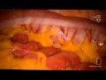 Inside Fat people. The truth 