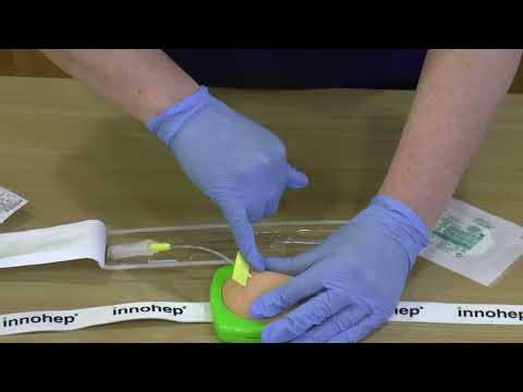 Demonstration on the insertion of a Saf T Intima for intermittent subcutaneous injections