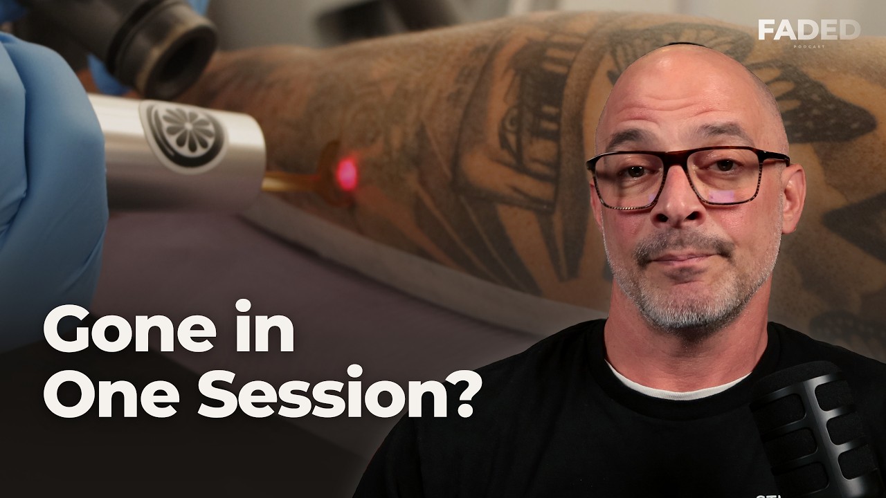 How Many Tattoo Removal Sessions Do You Really Need?