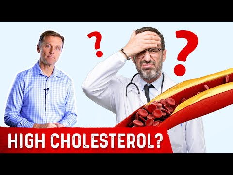 Dr. Berg's Wife Has Crazy High Cholesterol of 261..