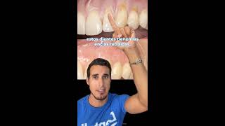 ENCÍAS RETRAÍDAS - Antes y después