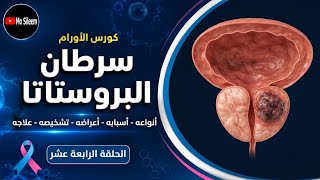 سرطان البروستاتا وتحليل PSA ☺️🔥