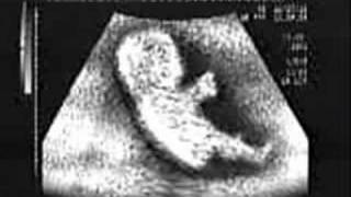 Baby in the womb driving
