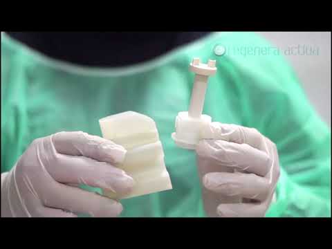 Rigenera technology explanation