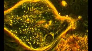 preview picture of video 'Weird Cells inside termite gut.wmv'