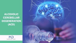 Alcoholic Cerebellar Degeneration (ACD): A Complex Neurological Condition @mdmedicine.network