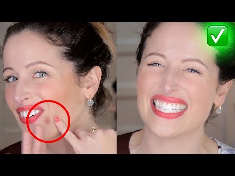Papillomas come lentiggine Pigmentary rosso nota su una faccia
