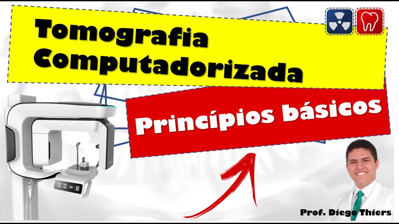 TOMOGRAFIA COMPUTADORIZADA - PRINCÍPIOS BÁSICOS - DO HISTÓRICO E EVOLUÇÃO ATÉ A FORMAÇÃO DA IMAGEM