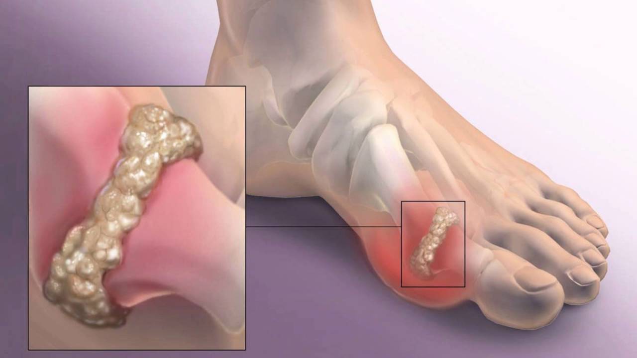 Почему болят большие пальцы на ногах