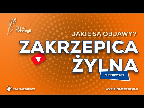 ZAKRZEPICA ŻYLNA - jakie są jej objawy