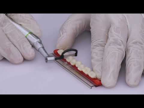 IPR orthodontic 4:1 reduction contra angle