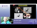 Surgery For CCA And Why Centres Of Expertise Are Necessary