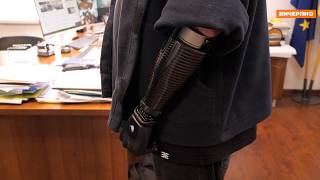 У Черкасах уперше проводять остеоінтегративне протезування