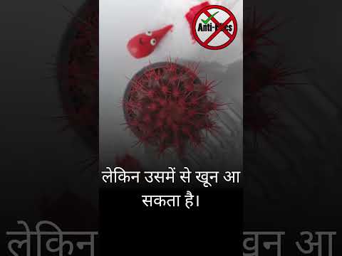 फर्स्ट डिग्री बवासीर के लक्षण?  #antipiles #motivation #piles #antipilesbhopal #pilesclinic #short