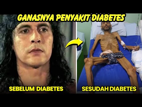 miris, 8 artis populer alami sakit diabetes hingga meninggal dunia