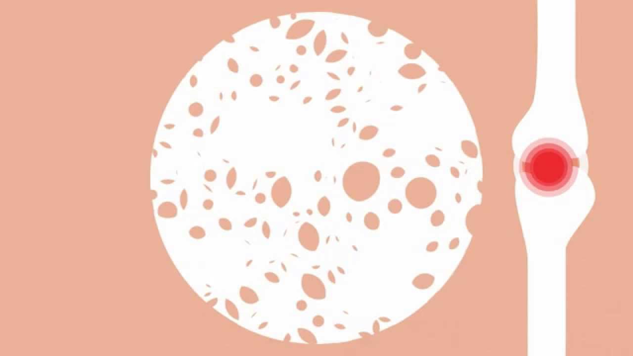 HealthKey.tv | Joint Mobility | Collagen For Joint Health