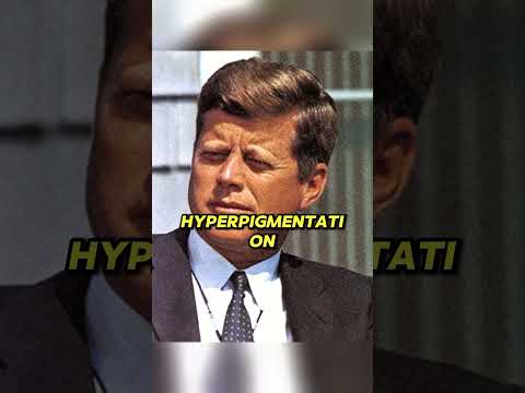 Why Was JFK Orange? #shorts