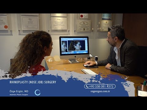 #Rhinoplasty (Nose Job) Journey | Ozge Ergun MD | Plastic Surgery | Istanbul