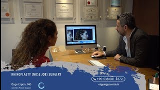 #Rhinoplasty (Nose Job) Journey | Ozge Ergun MD | Plastic Surgery | Istanbul