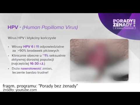 Nowy program "Porady bez żenady". Ginekolog: To nie pornografia, to czyste życie. Cz. 1 [Dobry Seks]