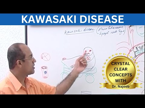 Kawasaki Disease | Clinical Features | Complications & Management