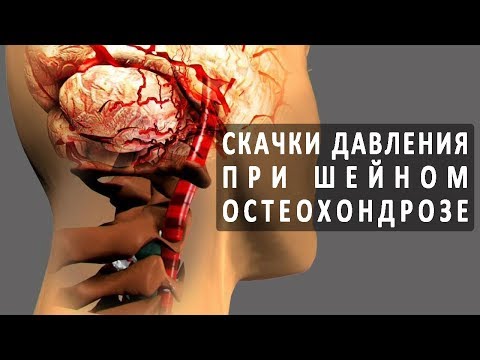 Замена коленного сустава екатеринбург отзывы Что может болеть при болях в пояснице
