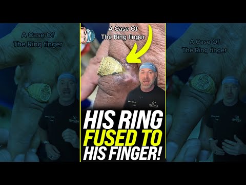 , title : 'Ring Got Stuck and FUSED to His Finger?! 😱 #shorts'