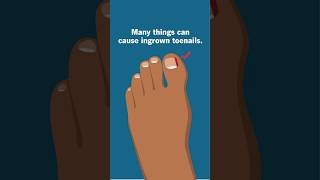 Causes of those painful ingrown toenails. Ouch!
