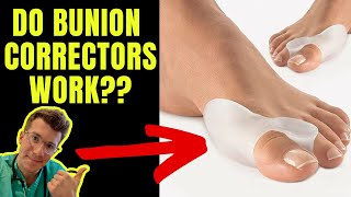 DO BUNION CORRECTORS WORK Doctor explains...
