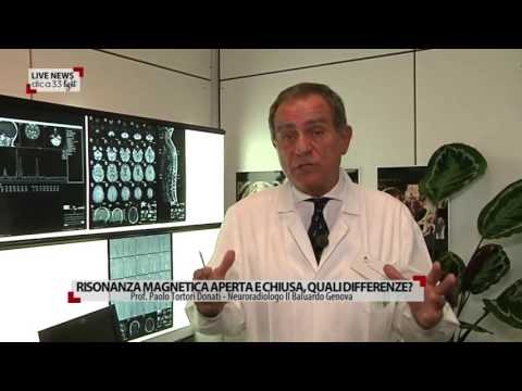 Dispositivi ortopedici per la colonna vertebrale toracica Come pulire le articolazioni sulle dita
