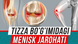 TIZZA OGRIQLARI VA ENG OSON DAVOSI.#rek ##reels # #doctorMuzb #uzbomtv #doctoruz #SHIFOKORMUHAMMAD..