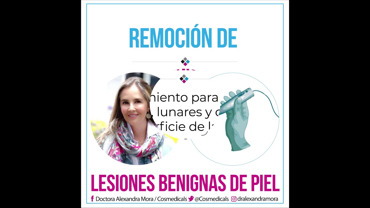 Alexandra Mora Hernandez-184