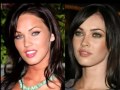 Megan Fox Plastic Surgery1