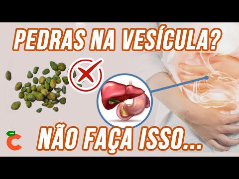 LIMPEZA DO FÍGADO E VESÍCULA BILIAR! DESINTOXICAÇÃO DE PEDRAS