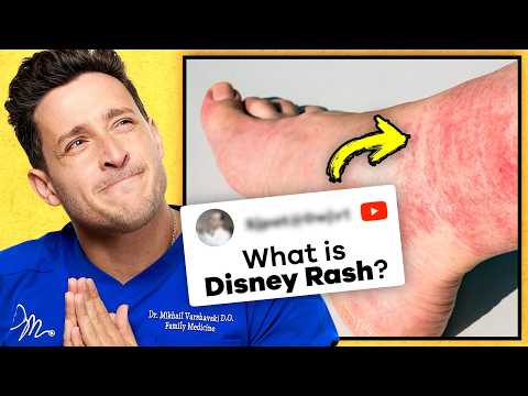 The Truth About The “Disney" Rash | RTC 38