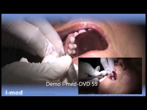 Fortbildung "Prophylaxe Live & Practice"