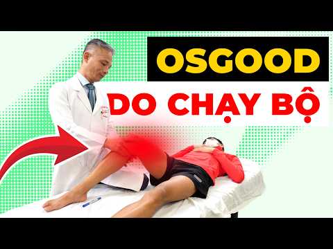 Tại sao chạy bộ gây Osgood? Sai lầm khiến đầu gối đau dai dẳng nhiều năm!