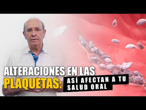 Plaquetas: qué son y cómo afectan a tu salud oral