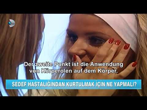 Wie das Vitamin d bei der Schuppenflechte zu verwenden Das Kalzium gljukonat die Rezensionen bei atopitscheskom die Hautentzündung
