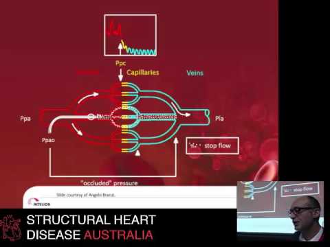 Right heart catheterisation & pulmonary pressures - A/Prof Eugene Kotyler