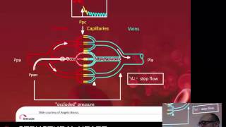 Right heart catheterisation & pulmonary pressures – A/Prof Eugene Kotyler
