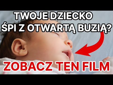 Otwarta buzia dziecka - czy to źle |Odcinek 104| Agnieszka Kaproń