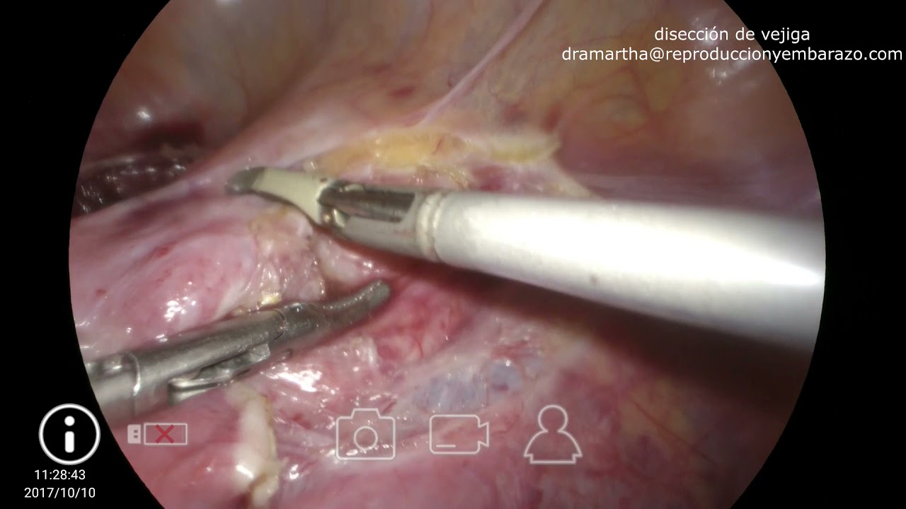 Jorge Alberto Rodriguez Pezino-62