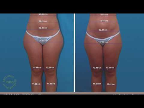 Reduxine review contact Slimming video sa YouTube