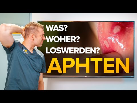 APHTEN - Was kann ich gegen Aphten tun? Woher kommen sie? Wie vermeiden?