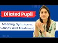 Dilated Pupil: Meaning, Symptoms, Causes, And Treatment | Mydriasis | Pupil Dilation