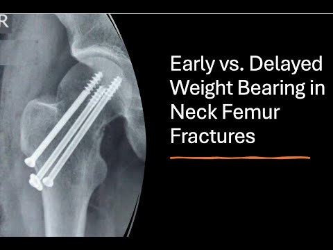 Neck Femur Fractures in Young: Early vs. Delayed Weight Bearing