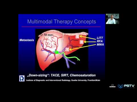 Professor Vogel. Intervention Oncology