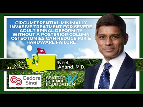Circumferential MIS Treatment for Severe Adult Spinal Deformity - Neel Anand, M.D.